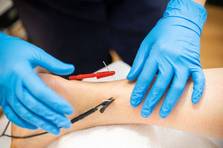 Can you hit a nerve while dry needling?